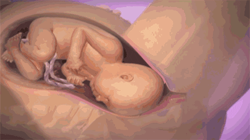 1504922749794661.gif 微信图片_20170908155410.gif